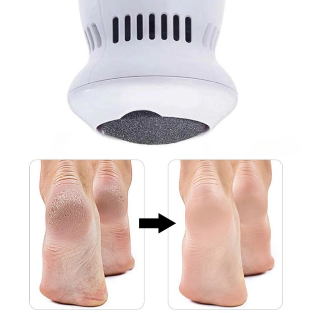 SmoothSole – Electric Foot File with Built-in Vacuum