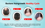 GlowGrow – Red Light Therapy for Healthy Hair Regrowth