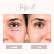 GlowLift – Firm & Smooth Eye Contour with Gentle Therapy