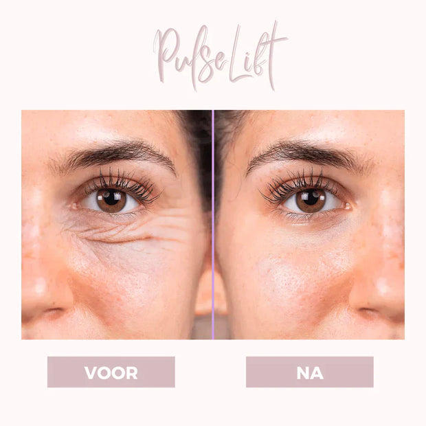 GlowLift – Firm & Smooth Eye Contour with Gentle Therapy