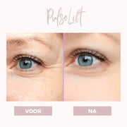 GlowLift – Firm & Smooth Eye Contour with Gentle Therapy